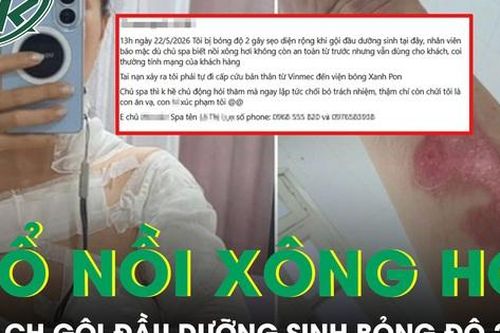 Nổ nồi xông hơi khi gội đầu dưỡng sinh, nữ khách bỏng độ 2 vùng cổ và ngực