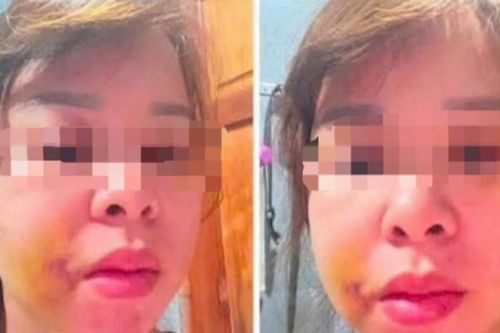 Người mẹ 3 con ở Đắk Lắk cầu cứu sau nhiều lần bị chồng hành hung