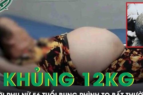 Bụng to bất thường, người phụ nữ 'khóc ngất' khi phát hiện khối u khổng lồ nặng tới 12kg