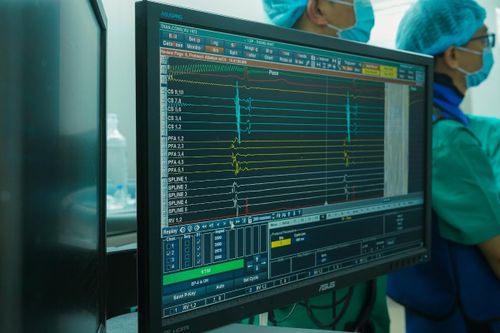 Công nghệ điều trị rung nhĩ hiện đại được triển khai tại nhiều bệnh viện Việt Nam