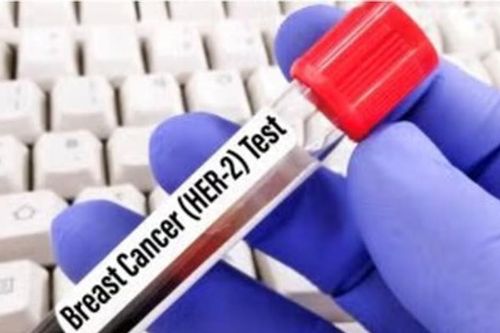 FDA ưu tiên xem xét đơn đăng ký thuốc giredestrant của Roche trong điều trị ung thư vú