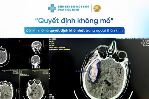 Quyết định không mổ đôi khi là quyết định khó nhất trong Ngoại thần kinh