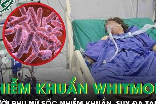 Người phụ nữ 43 tuổi sốc nhiễm khuẩn, suy đa tạng sau 5 ngày sốt