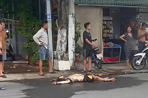 Nam thanh niên bỏng nặng nghi do phóng hỏa tiệm giặt sấy ở Cà Mau