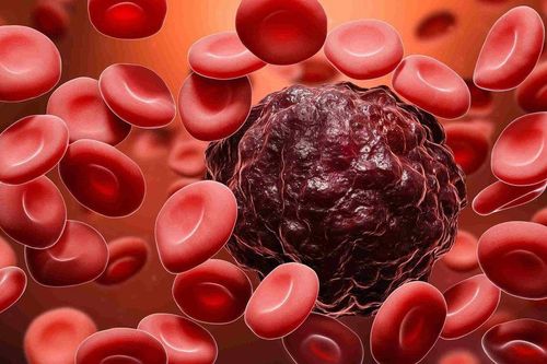 7 thói quen tưởng vô hại nhưng có thể âm thầm gây viêm mạn tính