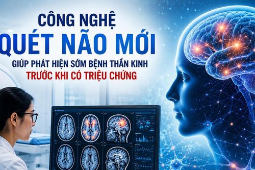 Công nghệ quét não mới giúp phát hiện sớm bệnh thần kinh trước khi có triệu chứng