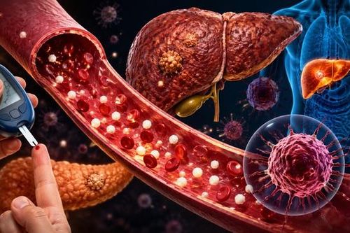 Đường huyết cao, kéo dài liên tục có thể liên quan đến một số bệnh ung thư