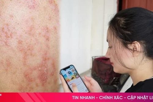 Mỹ phẩm online: Dễ mua - khó kiểm chứng chất lượng