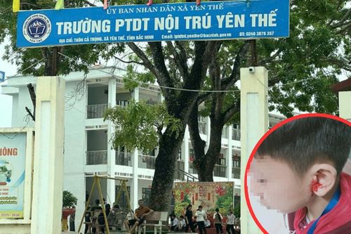 Bắc Ninh: Học sinh bị thầy giáo véo tai đến chảy máu
