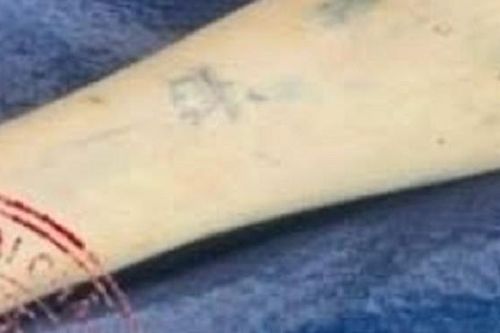 Cảnh sát truy tìm lai lịch thi thể có hình xăm vương miện trên cánh tay