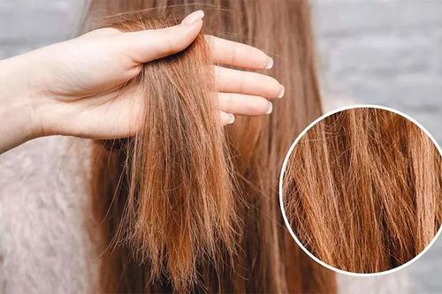 Dùng dầu gội đắt tiền nhưng tóc vẫn khô xơ? Nguyên nhân có thể nằm ở những thói quen hằng ngày