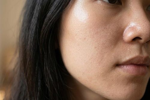 6 sai lầm khi chăm sóc da dầu khiến da càng đổ dầu