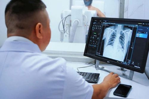 Những cơn ho tưởng vô hại nhưng lại là dấu hiệu của một căn bệnh hiểm nghèo