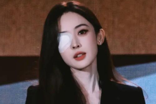 Cổ Lực Na Trát khiến fan lo lắng vì băng kín một bên mắt tại sự kiện