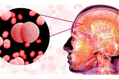 Nhận biết sớm dấu hiệu viêm não nguy hiểm