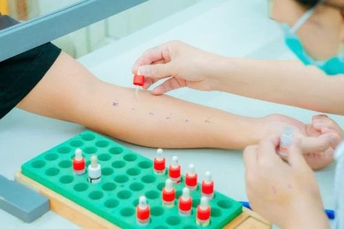 Nguy cơ khó lường từ dị ứng thuốc và thức ăn