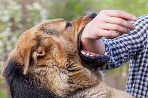 Chủ quan sau vết cắn của chó, người đàn ông 45 tuổi tử vong