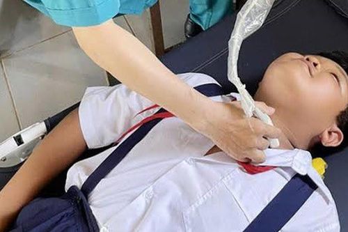 Trẻ em có mắc ung thư tuyến giáp không?