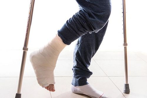 Lưu ý khi phục hồi chức năng sau gãy xương