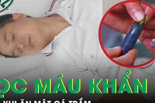 Người đàn ông 68 tuổi suy đa tạng phải lọc máu khẩn cấp sau khi ăn mật cá trắm