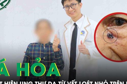 Tá hỏa phát hiện ung thư da từ vết loét nhỏ trên mặt