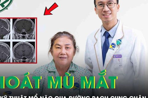 Mổ não qua đường rạch cung chân mày cứu người bệnh thoát nguy cơ mù mắt