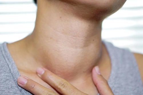 Bác sĩ cảnh báo 5 nhóm người dễ mắc một loại ung thư phổ biến