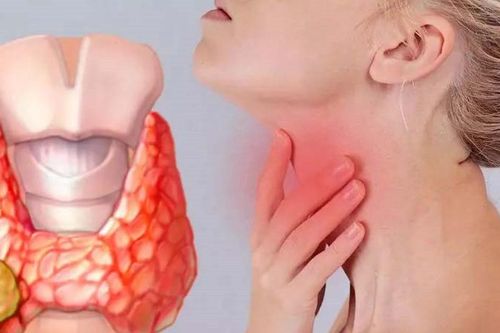Có những biểu hiện này, đừng chủ quan vì có thể là dấu hiệu ung thư