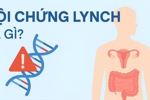 Phát hiện sớm hội chứng Lynch để ngăn ngừa ung thư