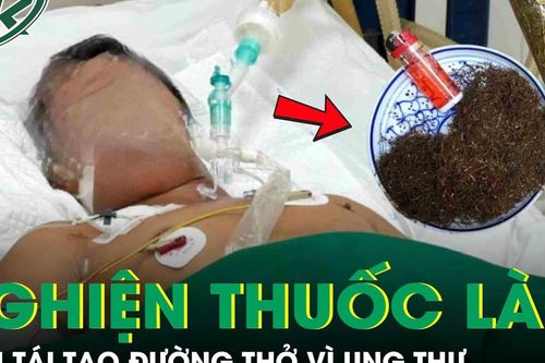 Người đàn ông phải tái tạo đường thở vì ung thư sau 30 năm nghiện thuốc lào