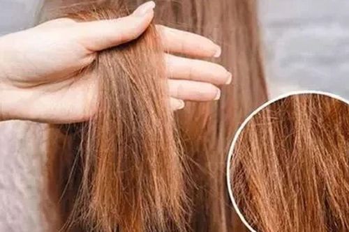Rụng tóc nhiều vào mùa hè đừng chủ quan: 5 thói quen âm thầm gây hại