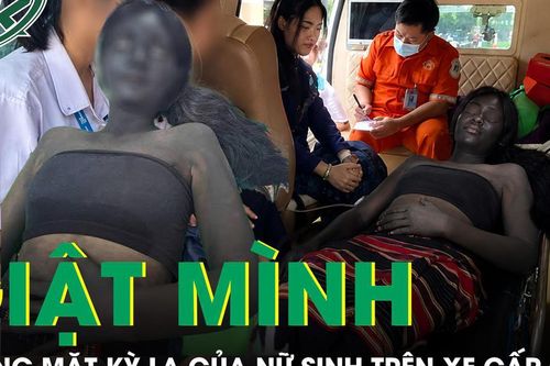 Đội cứu hộ giật mình khi thấy gương mặt kỳ lạ của nữ sinh trên xe cấp cứu