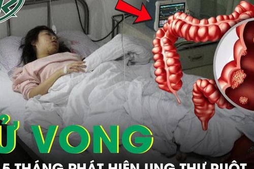 Cô gái 26 tuổi tử vong sau 5 tháng phát hiện ung thư ruột từ triệu chứng đau bụng