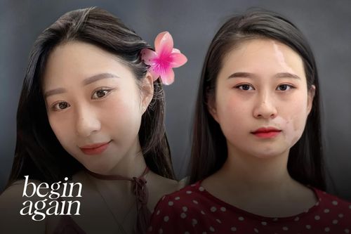 Ước mơ của cô gái xinh đẹp 20 năm bị căn bệnh tàn phá diện mạo