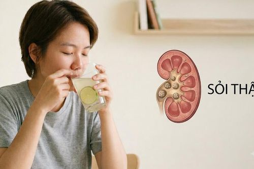 Người bị sỏi thận nên uống nước chanh hằng ngày như thế nào?