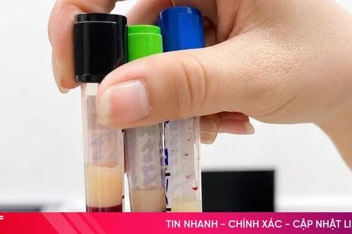 Gan bị tổn thương nặng vì thói quen xấu lặp lại mỗi ngày