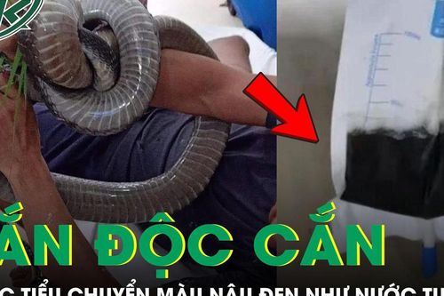 Đang quét sân, người đàn ông bị rắn độc cắn, nước tiểu bất ngờ chuyển màu nâu đen