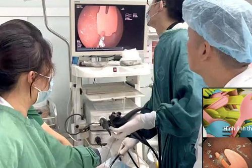 Cắn gãy thìa nhựa khi ăn sữa chua, bé 20 tháng tuổi phải nhập viện cấp cứu