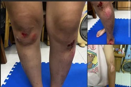 Công an xác minh thông tin vụ 2 cô gái bị đánh sau va chạm giao thông