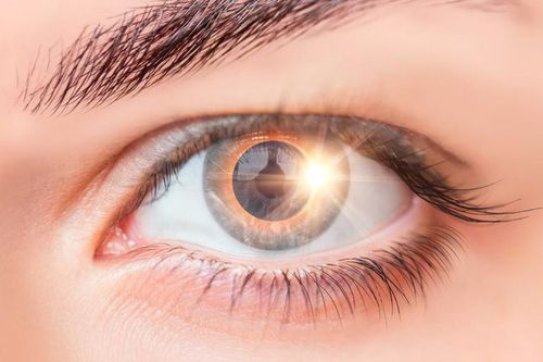 Cô gái suốt đời thấy hình lưỡi liềm trong mắt chỉ sau vài giây xem nhật thực