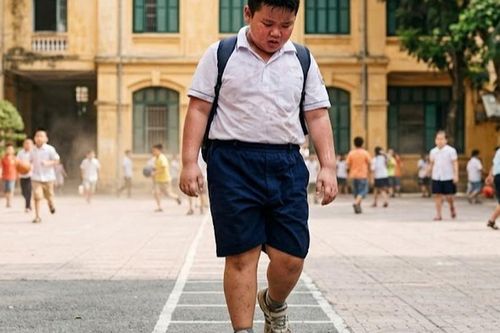 Những rủi ro về sức khỏe khi trẻ thừa cân, béo phì
