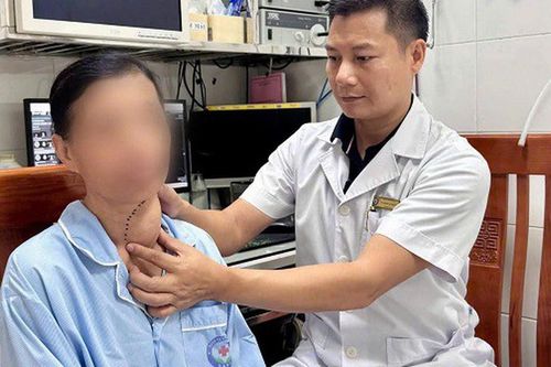 10 năm không điều trị, bướu giáp phát triển khổng lồ chèn ép khí quản