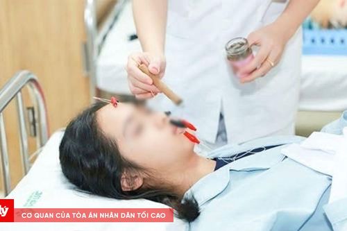 Nữ sinh bị lệch mặt do thói quen nhiều người mắc phải