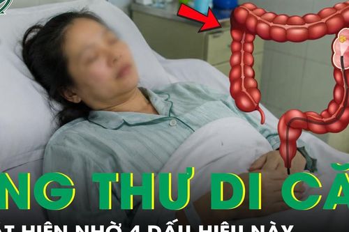 Người phụ nữ 53 tuổi phát hiện mắc ung thư di căn từ 4 dấu hiệu này