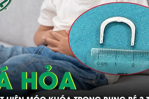 Tá hỏa phát hiện chiếc móc khóa hình chữ C trong bụng bé 3 tuổi