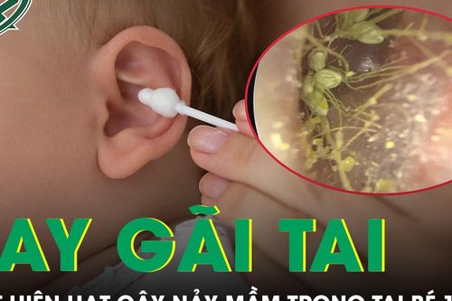 Bé trai liên tục gãi tai, bác sĩ phát hiện hạt cây đã nảy mầm bên trong