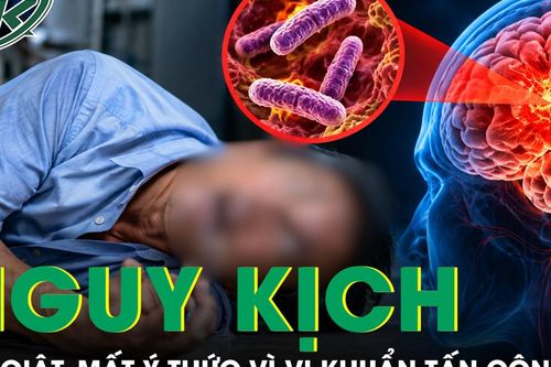 Người đàn ông 54 tuổi co giật, mất ý thức vì Whitmore tấn công não