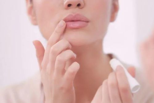 Môi khô, bong tróc và xỉn màu? 4 bước chăm sóc đơn giản giúp đôi môi mềm mịn, hồng hào