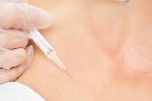Ổ mủ xen lẫn filler trong ngực cô gái 24 tuổi