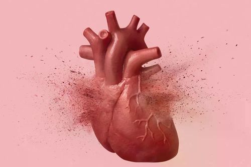 Phân biệt hội chứng 'con tim tan vỡ' và đau tim thông thường